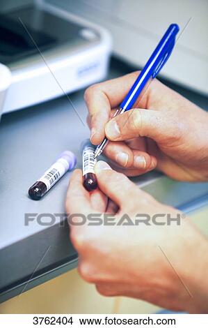 France, veterinary clinic. Blood. View Large Photo Image Picture - France, veterinary clinic. Blood.. Fotosearch