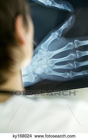Picture - Rear view of a female doctor examining an X-Ray report. Fotosearch