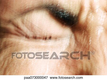 Stock Photo - Partial view of woman's wrinkled face, eye squeezed closed, blurred.. Fotosearch