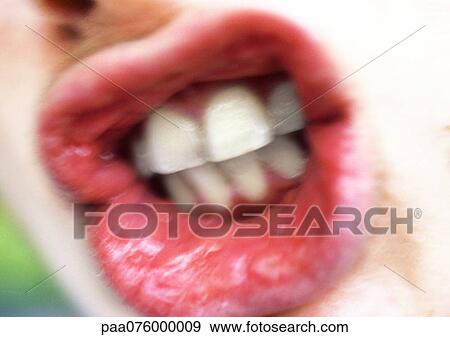 Stock Photo - Close up of woman's mouth showing teeth. Fotosearch