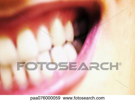 Stock Photo - Extreme close-up of woman's mouth, wide open, showing teeth, partial view, blurred. Fotosearch
