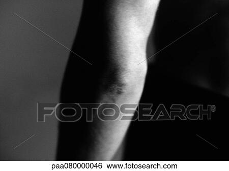 Stock Photograph - Man's elbow, close-up, black and white.. Fotosearch