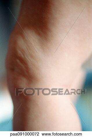 Stock Image - Baby's leg, close-up. Fotosearch