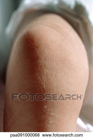 Stock Photo - Baby's leg, close-up. Fotosearch