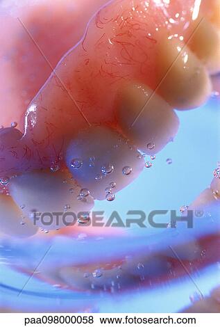 Stock Photo - Dentures in water, close-up. Fotosearch