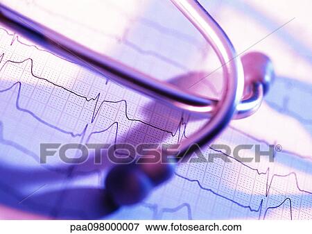 Stock Photo - Stethoscope on electrocardiogram read-out, close-up. Fotosearch
