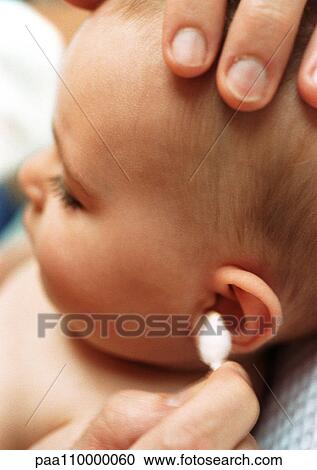 Stock Image - Baby having ear cleaned with cotton swab, close-up. Fotosearch