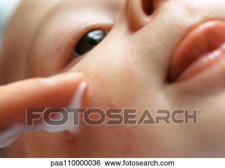Baby having lotion applied to pipmles on face, extreme close-up View Large Photo Image Stock Photograph - Baby having lotion applied to pipmles on face, extreme close-up. Fotosearch