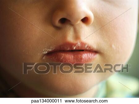 Young child with crumbs on face, close-up of mouth. View Large Photo Image Stock Image - Young child with crumbs on face, close-up of mouth.. Fotosearch