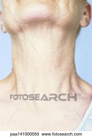 Mature woman, close-up of neck. View Large Photo Image Stock Photography - Mature woman, close-up of neck.. Fotosearch