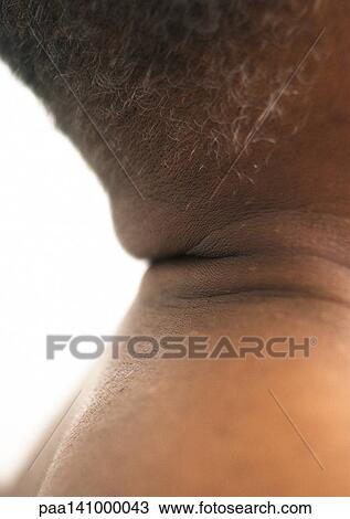 Senior man, close-up of back of head and back. View Large Photo Image Stock Image - Senior man, close-up of back of head and back.. Fotosearch