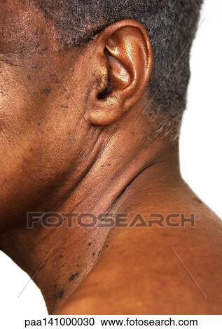Senior man's neck and head, partial view, close-up. View Large Photo Image Stock Image - Senior man's neck and head, partial view, close-up.. Fotosearch