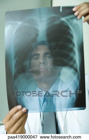 Doctor looking at x-ray View Large Photo Image Stock Photo - Doctor looking at x-ray. Fotosearch