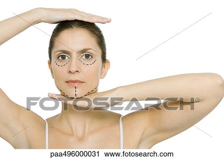 Woman with plastic surgery markings on face, framing head with hands, looking at camera View Large Photo Image Stock Image - Woman with plastic surgery markings on face, framing head with hands, looking at camera. Fotosearch