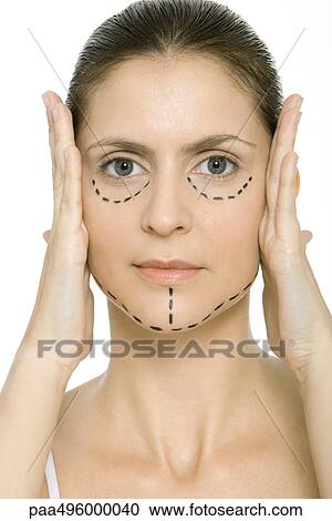 Woman with plastic surgery markings on face, holding face in hands, looking at camera View Large Photo Image Stock Image - Woman with plastic surgery markings on face, holding face in hands, looking at camera. Fotosearch