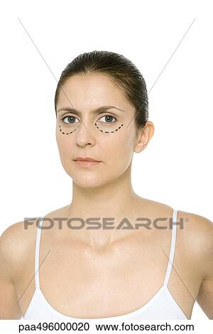 Woman with plastic surgery markings under her eyes, portrait View Large Photo Image Stock Image - Woman with plastic surgery markings under her eyes, portrait. Fotosearch
