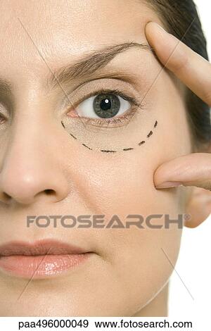 Woman with plastic surgery markings under one eye, touching face, looking at camera, close-up View Large Photo Image Stock Photo - Woman with plastic surgery markings under one eye, touching face, looking at camera, close-up. Fotosearch