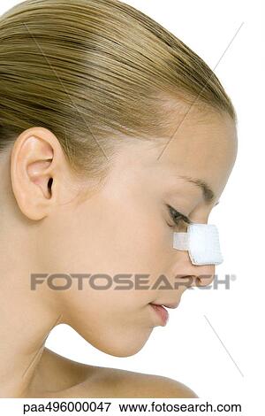 Young woman with bandaged nose, profile View Large Photo Image Stock Photo - Young woman with bandaged nose, profile. Fotosearch