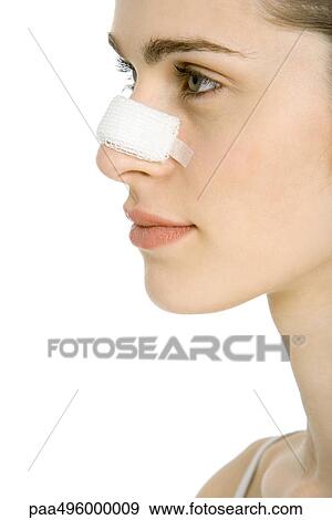 Stock Photo - Young woman with bandaged nose, profile, cropped. Fotosearch