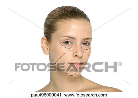 Young woman with plastic surgery markings on face, looking at camera View Large Photo Image Stock Image - Young woman with plastic surgery markings on face, looking at camera. Fotosearch