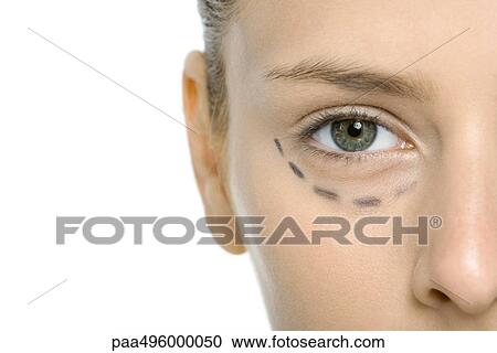 Young woman with plastic surgery markings under eye, cropped view View Large Photo Image Stock Image - Young woman with plastic surgery markings under eye, cropped view. Fotosearch