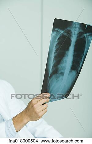 Picture - Doctor holding up x-ray of rib cage, partial view. Fotosearch