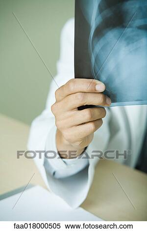 Doctor holding up x-ray of rib cage, partial view View Large Photo Image Stock Photography - Doctor holding up x-ray of rib cage, partial view. Fotosearch