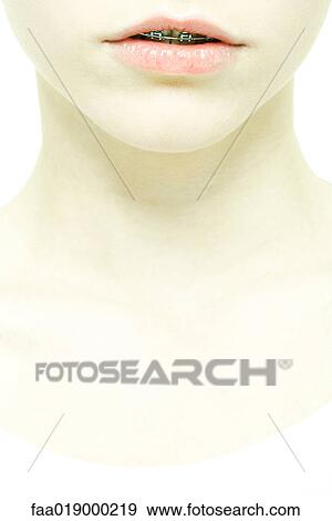 Stock Photo - Teenage girl with braces, extreme close-up of lower face and neck. Fotosearch