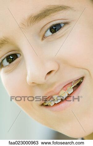Boy with braces smiling at camera, portrait View Large Photo Image Stock Image - Boy with braces smiling at camera, portrait. Fotosearch