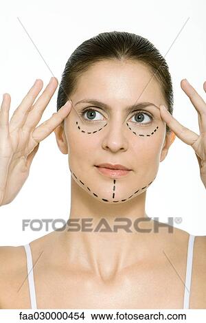 Picture - Woman with plastic surgery markings on face, holding temples, looking away. Fotosearch
