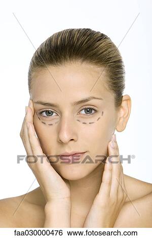 Stock Photograph - Woman with plastic surgery markings under eyes, holding face, looking at camera. Fotosearch