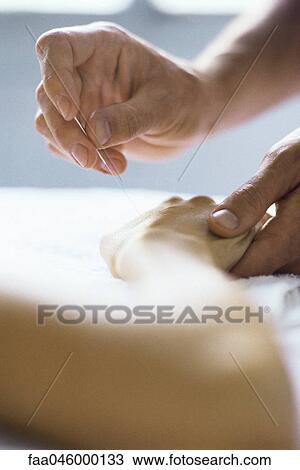 Acupuncture needle being inserted in patient's hand View Large Photo Image Stock Image - Acupuncture needle being inserted in patient's hand. Fotosearch
