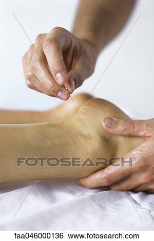 Acupuncture needle being inserted in patient's ankle View Large Photo Image Stock Photograph - Acupuncture needle being inserted in patient's ankle. Fotosearch