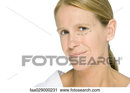 Woman with plastic surgery markings under one eye, smiling at camera View Large Photo Image Stock Image - Woman with plastic surgery markings under one eye, smiling at camera. Fotosearch