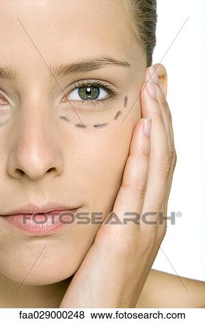 Woman with plastic surgery markings under eye, holding face, looking at camera, cropped View Large Photo Image Stock Photo - Woman with plastic surgery markings under eye, holding face, looking at camera, cropped. Fotosearch