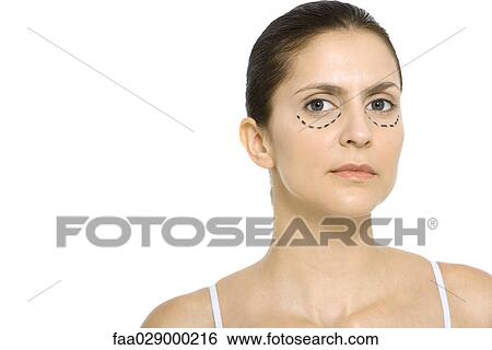 Woman with plastic surgery markings under eyes, looking at camera View Large Photo Image Stock Photograph - Woman with plastic surgery markings under eyes, looking at camera. Fotosearch