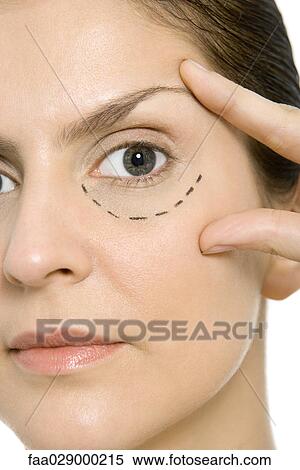 Woman with plastic surgery markings under one eye, touching face, looking at camera View Large Photo Image Stock Photography - Woman with plastic surgery markings under one eye, touching face, looking at camera. Fotosearch