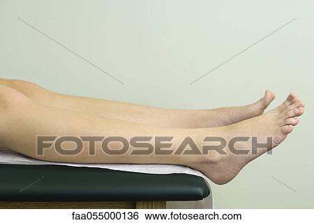 Stock Photograph - Patient on examination table preparing for exam, close-up of leg. Fotosearch