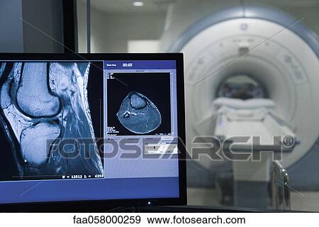 MRI scan result on computer monitor View Large Photo Image Stock Photo - MRI scan result on computer monitor. Fotosearch