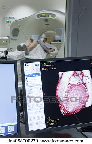 Patient's heart CAT scan result shown on monitor View Large Photo Image Stock Image - Patient's heart CAT scan result shown on monitor. Fotosearch