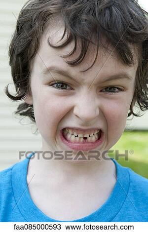 Stock Image - Boy grimacing, showing missing tooth, portrait. Fotosearch
