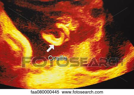 Ultrasound scan of developing fetus View Large Photo Image Stock Photography - Ultrasound scan of developing fetus. Fotosearch