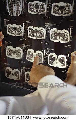 Picture - Doctor's hands pointing to an X-ray. Fotosearch