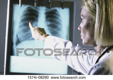 Stock Image - Female doctor pointing at a chest X-ray. Fotosearch