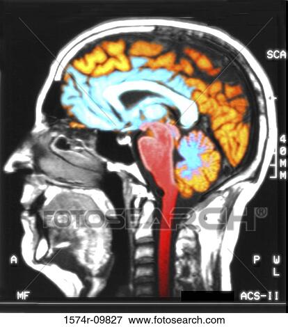 MRI scan of a human head View Large Photo Image Stock Photo - MRI scan of a human head. Fotosearch