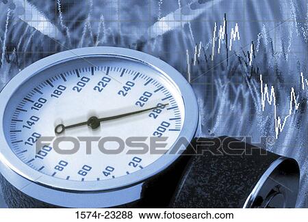 Stock Photo - Close-up of a blood pressure gauge. Fotosearch