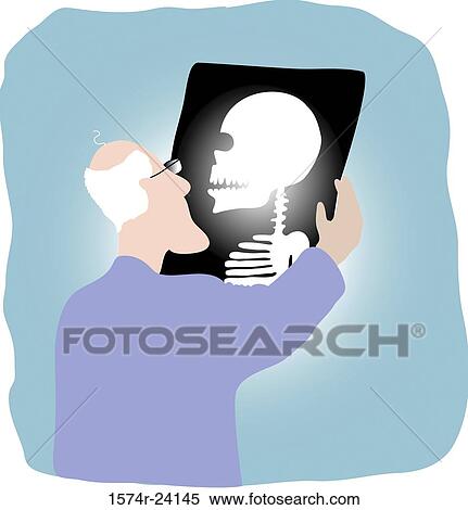 Stock Photography - Head Xray, Linda Braucht (20th C. American), Computer Graphics. Fotosearch