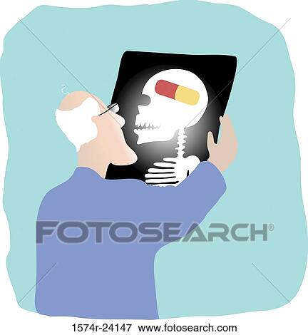 Stock Photo - Pill in Head, Linda Braucht (20th C. American), Computer Graphics. Fotosearch