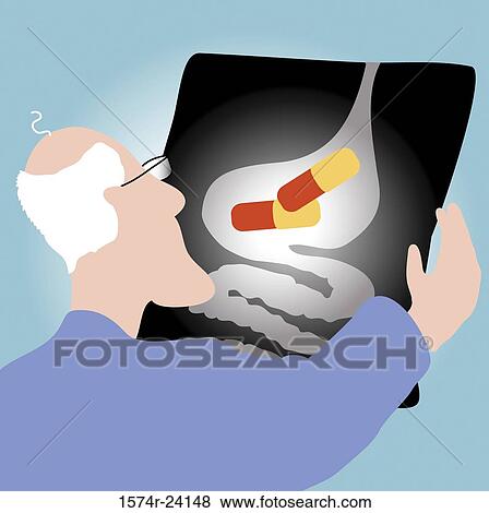 Stock Photo - Stomach Xray, Linda Braucht (20th C. American), Computer Graphics. Fotosearch