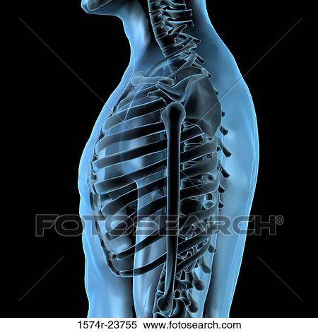 Stock Photography - X-ray of human ribs. Fotosearch